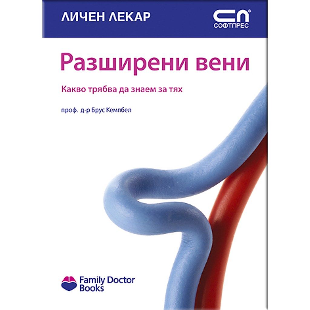 Разширени вени