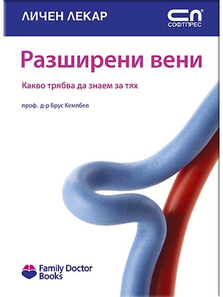Разширени вени